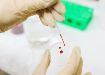 OPS recomienda nuevo test de Covid-19, lanza programa piloto