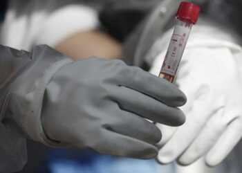 Casos de coronavirus rebasan los 50 millones a nivel mundial