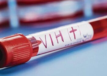 La simple exposición al VIH altera en niños varios biomarcadores inmunitarios