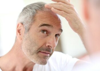 El injerto capilar, una alternativa a la caída del cabello