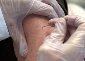 Argentina reporta primer caso sospechoso de viruela del mono