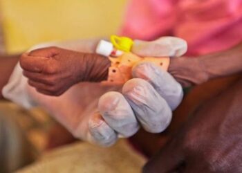 828 millones de personas sufrieron hambre en el mundo por la pandemia