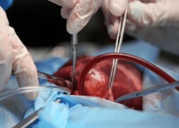 ONG exigieron reactivación de programa de trasplantes de órganos