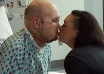 En un hospital de Nueva York logran por primera vez trasplantar un ojo entero a un paciente