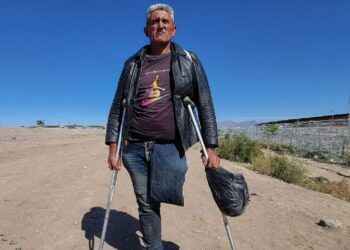 Venezolano llega con un solo pie a la frontera de México en busca de una prótesis en EE.UU