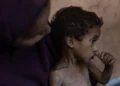 La desnutrición causa la muerte de otras cinco personas en las últimas 24 horas en Gaza