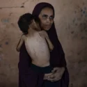 Han muerto más gazatíes por desnutrición en lo que va de 2025 que en los dos años previos