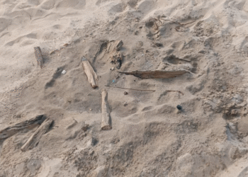 Exigen justicia para niña que sufrió quemaduras por restos de una fogata en Puerto Morro