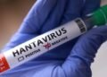 Autoridades sanitarias reconocen la prolongada ventana de incubación como el mayor obstáculo para el control del hantavirus