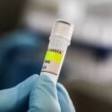 Minsalud confirma tres muertes por Hantavirus en Anzoátegui (+Comunicado)